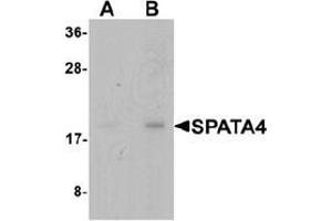 Western blot analysis of SPATA4 in mouse stomach tissue lysate with SPATA4 Antibody  at (A) 1 and (B) 2 μg/mL (SPATA4 anticorps  (C-Term))