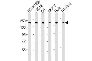 All lanes : Anti-ROCK2 Antibody (C-term) at 1:2000 dilution Lane 1: NCI- whole cell lysates Lane 2: C2C12 whole cell lysates Lane 3: C6 whole cell lysates Lane 4: MCF-7 whole cell lysates Lane 5: Hela whole cell lysates Lane 6: HT-1080 whole cell lysates Lysates/proteins at 20 μg per lane.
