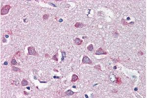 ABIN334445 (5µg/ml) staining of paraffin embedded Human Cortex. (Merlin anticorps  (Internal Region))