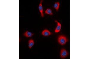 Immunofluorescent analysis of IKB epsilon (pS22) staining in HeLa cells. (NFKBIE anticorps  (pSer22))