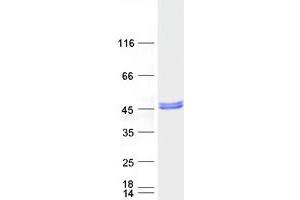 Validation with Western Blot
