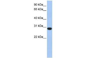 ASB12 antibody used at 1 ug/ml to detect target protein.