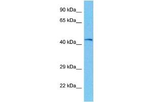 Host:  Mouse  Target Name:  PHKG2  Sample Tissue:  Mouse Kidney  Antibody Dilution:  1ug/ml