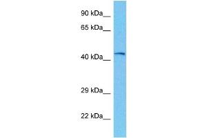 Host:  Mouse  Target Name:  PHKG2  Sample Tissue:  Mouse Kidney  Antibody Dilution:  1ug/ml (PHKG2 anticorps  (N-Term))