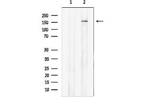 anti-ATP-Binding Cassette, Sub-Family A (ABC1), Member 6 (ABCA6) (Internal Region) antibody