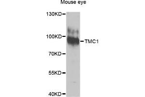 Western blot analysis of extracts of Mouse eye cells, using TMC1 antibody. (TMC1 anticorps)