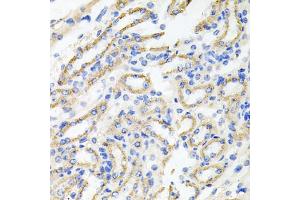 Immunohistochemistry of paraffin-embedded mouse kidney using IRAK2 antibody (ABIN1873258) at dilution of 1:100 (40x lens).