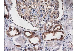 Image no. 4 for anti-Destrin (Actin Depolymerizing Factor) (DSTN) antibody (ABIN1497907)