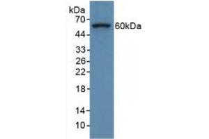 Figure. (COL8A1 anticorps  (AA 590-744))