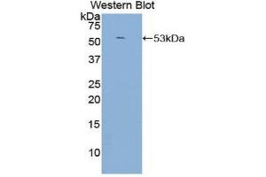 Western Blotting (WB) image for anti-Complement Component (3d/Epstein Barr Virus) Receptor 2 (CR2) (AA 729-957) antibody (ABIN1858487) (CD21 anticorps  (AA 729-957))