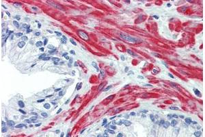 Human Prostate: Formalin-Fixed, Paraffin-Embedded (FFPE)