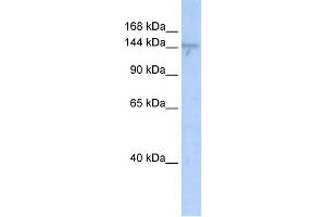 WB Suggested Anti-ZMYND8 Antibody Titration:  0. (ZMYND8 anticorps  (N-Term))