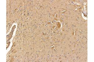 ABIN6265053 and ABIN6279817 at 1/100 staining rat brain tissue by IHC-P. (SH3BGRL anticorps  (Internal Region))