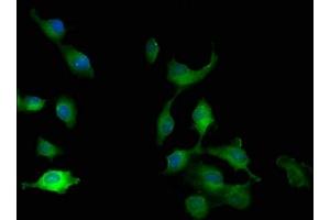 Immunofluorescence staining of U251 cells with ABIN7165606 at 1:100, counter-stained with DAPI. (FRY-Like anticorps  (AA 42-739))
