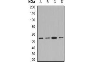 Western blot analysis of AEBP2 expression in Jurkat (A), A549 (B), mouse kidney (C), rat heart (D) whole cell lysates.