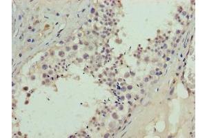 Immunohistochemistry of paraffin-embedded human testis tissue using ABIN7145267 at dilution of 1:100 (BATF2 anticorps  (AA 1-189))