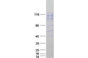 Validation with Western Blot