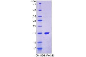 SDS-PAGE analysis of Human TRPV3 Protein. (TRPV3 Protéine)