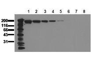 Western Blotting (WB) image for anti-Epidermal Growth Factor Receptor (EGFR) (AA 960-980) antibody (ABIN126763) (EGFR anticorps  (AA 960-980))