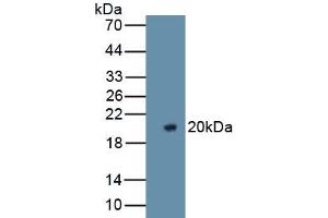 Detection of Recombinant F5, Rat using Polyclonal Antibody to Coagulation Factor V (F5)