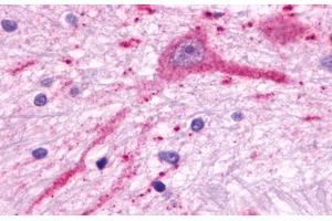 Image no. 1 for anti-Melanin-Concentrating Hormone Receptor 2 (MCHR2) (C-Term) antibody (ABIN1049056) (MCHR2 anticorps  (C-Term))