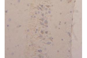 Detection of NGAL in Rat Brain Tissue using Polyclonal Antibody to Neutrophil gelatinase-associated lipocalin (NGAL) (Lipocalin 2 anticorps  (AA 21-198))