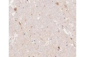 ABIN6266518 at 1/200 staining human brain tissue sections by IHC-P.