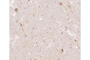 ABIN6266518 at 1/200 staining human brain tissue sections by IHC-P. (PTGS1 anticorps  (C-Term))
