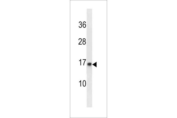 POMP anticorps  (C-Term)