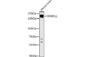 Western blot analysis of extracts of Mouse brain, using SP antibody (ABIN7270512) at 1:1000 dilution. (SPARCL1 anticorps  (AA 17-300))