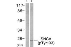 Western blot analysis of extracts from 293 cells treated with Etoposide 25 muM 60', using Synuclein-alpha (Phospho-Tyr133) Antibody. (SNCA anticorps  (pTyr133))
