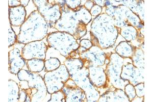 Formalin-fixed, paraffin-embedded human Placenta stained with Insulin Receptor Rabbit Recombinant Monoclonal Antibody (INSR/2277R). (Recombinant Insulin Receptor anticorps  (Extracellular Domain))