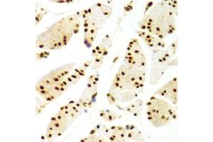 Immunohistochemistry of paraffin-embedded human esophagus using ELAVL1 Antibody.