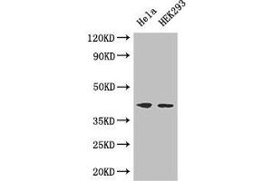 Western Blot Positive WB detected in: Hela whole cell lysate, HEK293 whole cell lysate All lanes: ACTG1 antibody at 3 μg/mL Secondary Goat polyclonal to rabbit IgG at 1/50000 dilution Predicted band size: 42 kDa Observed band size: 42 kDa (Actin, gamma 1 anticorps  (AA 13-166))