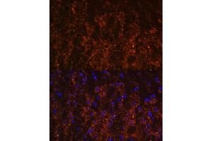 Immunofluorescence analysis of mouse brain using SNX13 antibody (ABIN6129554, ABIN6148236, ABIN6148237 and ABIN6216585) at dilution of 1:100.