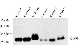 Western Blot analysis of various samples using THY1 Polyclonal Antibody at dilution of 1:1000. (CD90 anticorps)
