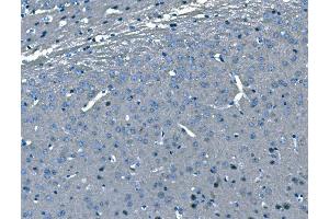 IHC analysis of B Raf/BRAF using anti-B Raf/BRAF antibody (ABIN3043761). (BRAF anticorps  (AA 38-230))