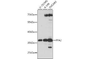 Western blot analysis of extracts of various cell lines, using PP antibody (ABIN7269763) at 1:1000 dilution. (PPA2 anticorps  (AA 33-100))
