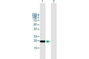 Western Blot analysis of MRPL49 expression in transfected 293T cell line by MRPL49 MaxPab polyclonal antibody. (MRPL49 anticorps  (AA 1-166))