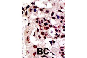 Immunohistochemistry (IHC) image for anti-Protein Inhibitor of Activated STAT, 3 (PIAS3) antibody (ABIN2996753) (PIAS3 anticorps)