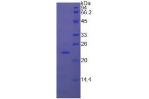 SDS-PAGE analysis of Cow RBP4 Protein. (RBP4 Protéine)
