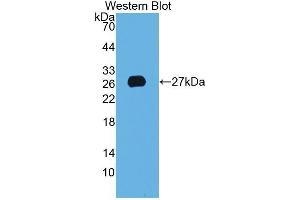 Western Blotting (WB) image for anti-Anterior Gradient Homolog 2 (Xenopus Laevis) (AGR2) (AA 21-175) antibody (ABIN1077802) (AGR2 anticorps  (AA 21-175))