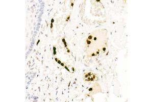 Immunohistochemistry of paraffin-embedded human esophagus using Neutrophil Elastase (ELANE) Rabbit pAb (ABIN6131604, ABIN6140110, ABIN6140111 and ABIN6216843) at dilution of 1:25 (40x lens). (ELANE anticorps  (AA 30-267))