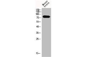 Western Blot analysis of MOuse-brain cells using Epsin 1 Polyclonal Antibody