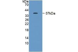 Detection of Recombinant KEAP1, Human using Polyclonal Antibody to Kelch Like ECH Associated Protein 1 (KEAP1) (KEAP1 anticorps  (AA 327-624))