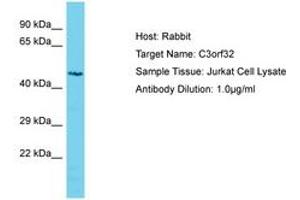 Image no. 1 for anti-Ssu-2 Homolog (C. Elegans) (SSUH2) (AA 184-233) antibody (ABIN6750606) (SSUH2 anticorps  (AA 184-233))
