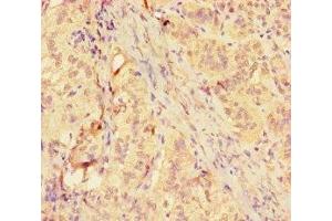Immunohistochemistry of paraffin-embedded human adrenal gland tissue using ABIN7158878 at dilution of 1:100 (MMP12 anticorps  (AA 109-470))