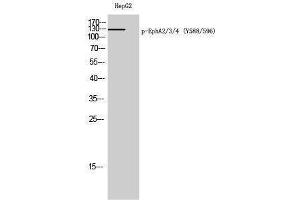 anti-EPH Receptor A2/3/4 (EPHA2/3/4) (pTyr588), (pTyr596) antibody