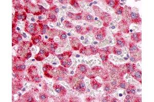 Anti-MKP-8 / DUSP26 antibody IHC of human liver. (DUSP26 anticorps  (C-Term))