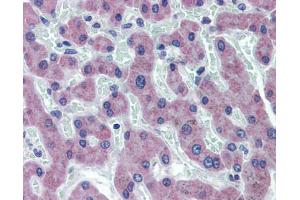 Liver, Human: Formalin-Fixed, Paraffin-Embedded (FFPE)